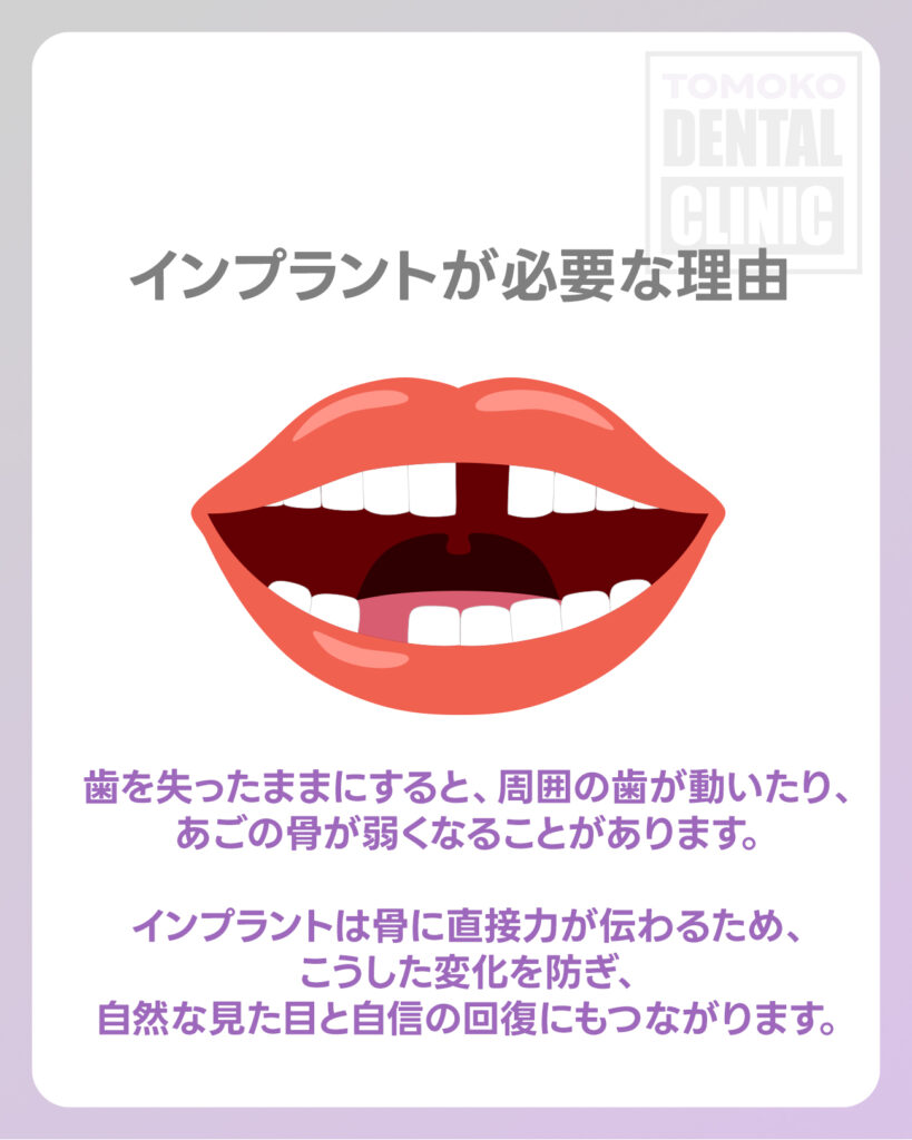 大阪 女性 歯医者