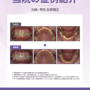 大手前 矯正
