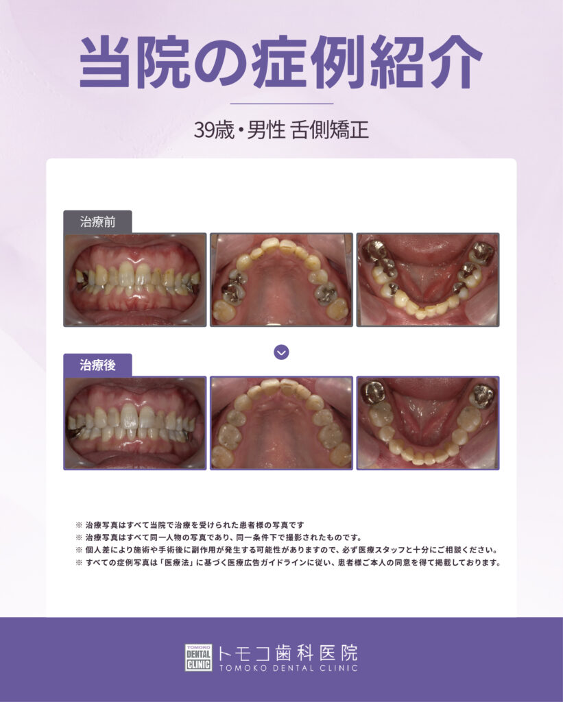 大手前 矯正